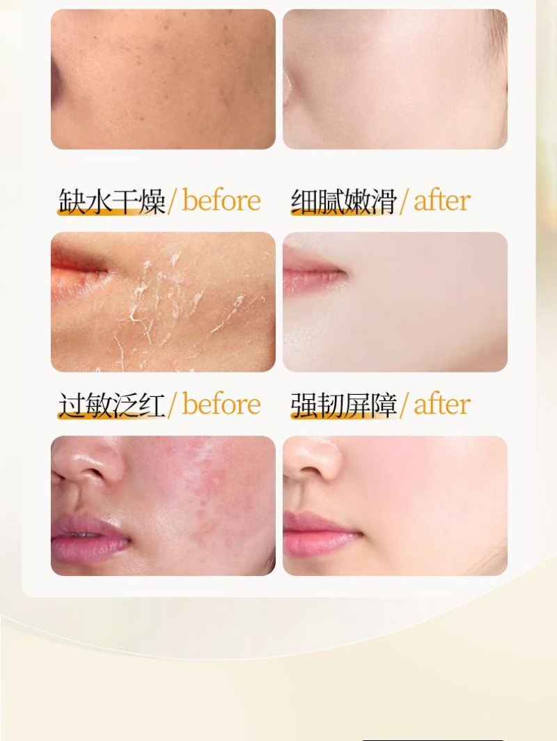 Tonique Visage Anti-Teint Tern - Essence Serum Toner avis et prix